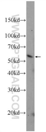 PDI Antibody in Western Blot (WB)