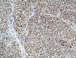 MUM1/IRF4 Antibody in Immunohistochemistry (Paraffin) (IHC (P))