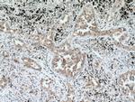 SCYL3 Antibody in Immunohistochemistry (Paraffin) (IHC (P))