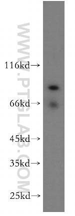 SCYL3 Antibody in Western Blot (WB)