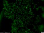 SUMO2/3 Antibody in Immunocytochemistry (ICC/IF)