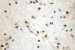 SUMO2/3 Antibody in Immunohistochemistry (Paraffin) (IHC (P))