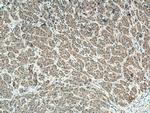 PMM1 Antibody in Immunohistochemistry (Paraffin) (IHC (P))