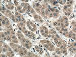 PMM1 Antibody in Immunohistochemistry (Paraffin) (IHC (P))