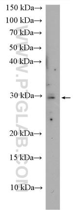 PMM1 Antibody in Western Blot (WB)