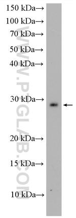 PMM1 Antibody in Western Blot (WB)