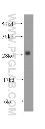PMM1 Antibody in Western Blot (WB)