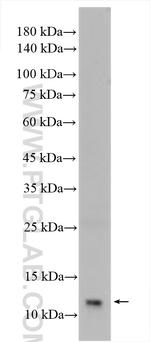 SH3BGRL Antibody in Western Blot (WB)