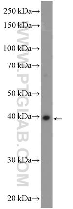 RAD51AP1 Antibody in Western Blot (WB)