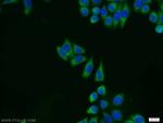 ERK1/2 Antibody in Immunocytochemistry (ICC/IF)