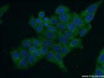 ERO1LB Antibody in Immunocytochemistry (ICC/IF)