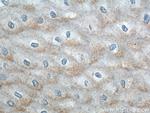 ERO1LB Antibody in Immunohistochemistry (Paraffin) (IHC (P))