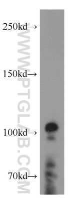 XRN2 Antibody in Western Blot (WB)