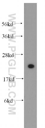 RPL13 Antibody in Western Blot (WB)