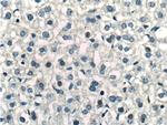 PPP2R5C Antibody in Immunohistochemistry (Paraffin) (IHC (P))