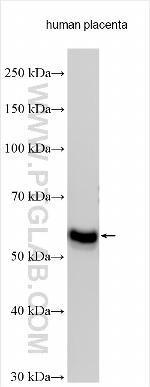 PPP2R5C Antibody in Western Blot (WB)