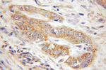 Tom22 Antibody in Immunohistochemistry (Paraffin) (IHC (P))
