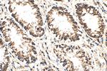 Tom22 Antibody in Immunohistochemistry (Paraffin) (IHC (P))