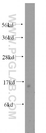 Tom22 Antibody in Western Blot (WB)