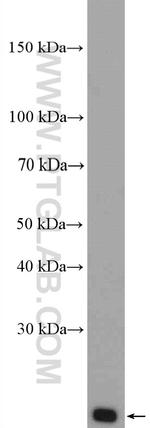 Tom22 Antibody in Western Blot (WB)