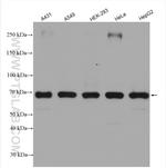 EIF4G3 Antibody in Western Blot (WB)
