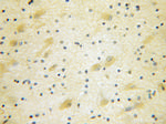 EIF4G3 Antibody in Immunohistochemistry (Paraffin) (IHC (P))