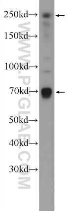 EIF4G3 Antibody in Western Blot (WB)
