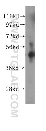 ZNF2 Antibody in Western Blot (WB)