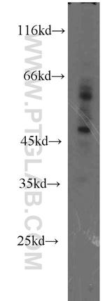 ZNF2 Antibody in Western Blot (WB)