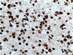 TLE1 Antibody in Immunohistochemistry (Paraffin) (IHC (P))
