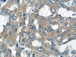 RNF156 Antibody in Immunohistochemistry (Paraffin) (IHC (P))