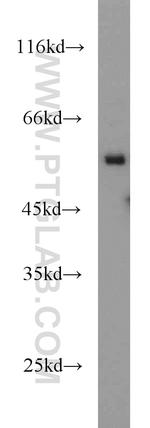 RNF156 Antibody in Western Blot (WB)