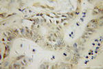 PARP3 Antibody in Immunohistochemistry (Paraffin) (IHC (P))