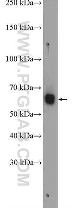 PARP3 Antibody in Western Blot (WB)