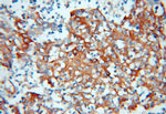 RPLP0 Antibody in Immunohistochemistry (Paraffin) (IHC (P))