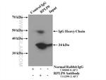RPLP0 Antibody in Immunoprecipitation (IP)