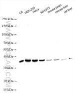 RPLP0 Antibody in Western Blot (WB)