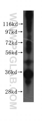 RPLP0 Antibody in Western Blot (WB)