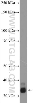 RPLP0 Antibody in Western Blot (WB)
