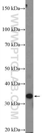 RPLP0 Antibody in Western Blot (WB)