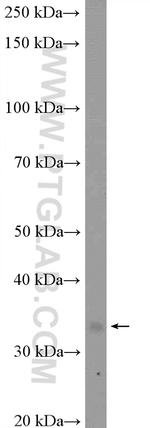 RPLP0 Antibody in Western Blot (WB)