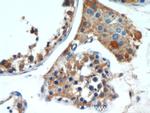 ALR Antibody in Immunohistochemistry (Paraffin) (IHC (P))