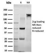 NACC1/Nac1/BTBD14B Antibody in SDS-PAGE (SDS-PAGE)