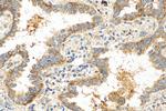 SPIRE1 Antibody in Immunohistochemistry (Paraffin) (IHC (P))