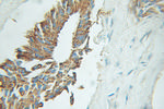 EIF2B3 Antibody in Immunohistochemistry (Paraffin) (IHC (P))