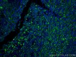 HLA-DPB1 Antibody in Immunohistochemistry (PFA fixed) (IHC (PFA))