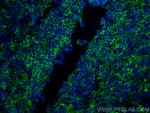 HLA-DPB1 Antibody in Immunohistochemistry (PFA fixed) (IHC (PFA))