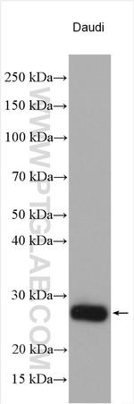HLA-DPB1 Antibody in Western Blot (WB)