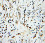 TADA2L Antibody in Immunohistochemistry (Paraffin) (IHC (P))
