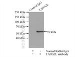 TADA2L Antibody in Immunoprecipitation (IP)